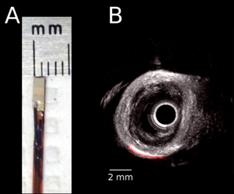 Biopsy Medical Robotics