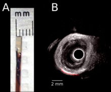 Biopsy Medical Robotics